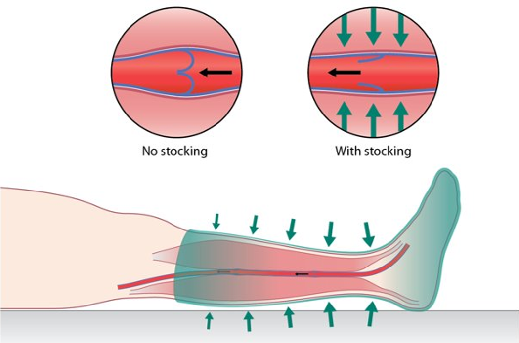 FITLEGS- ANTI EMBOLISM stockings - AES Grip - 4 pairs £9.95